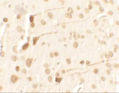 Immunohistochemistry: TPT1/TCTP Antibody [NBP2-41206] - Immunohistochemistry of TPT1 in rat brain tissue with TPT1 antibody at 2.5 ug/ml.