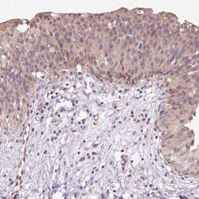 Immunohistochemistry-Paraffin: TPT1/TCTP Antibody [NBP2-38447] - Staining of human urinary bladder shows moderate cytoplasmic positivity in urothelial cells.