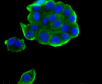 Immunocytochemistry/Immunofluorescence: TPT1/TCTP Antibody (JU13-32) [NBP2-75686] - Staining TCTP in LOVO cells (green). The nuclear counter stain is DAPI (blue). Cells were fixed in paraformaldehyde, permeabilised with 0.25% Triton X100/PBS.