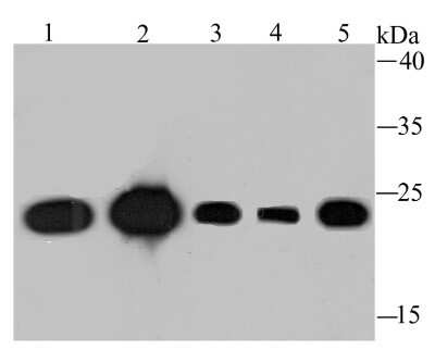 Western Blot: TPT1/TCTP Antibody (JU13-32) [NBP2-75686] - Analysis of TCTP on different lysates using anti-TCTP antibody at 1/1,000 dilution.Positive control:Lane 1: Mouse placenta  tissue Lane 2: Mouse testis tissueLane 3: Hela    Lane 4: A431   Lane 5: MCF-7