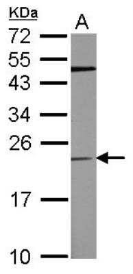 Western Blot: TPT1/TCTP Antibody [NBP2-20589] - Sample (50 ug of whole cell lysate) A: Mouse Brain, 12% SDS PAGE gel, diluted at 1:500.