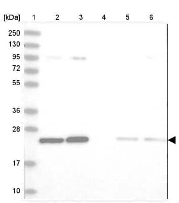 Western Blot: TPT1/TCTP Antibody [NBP2-38447] - Lane 1: Marker  [kDa] 250, 130, 95, 72, 55, 36, 28, 17, 10.  Lane 2: Human cell line RT-4.  Lane 3: Human cell line U-251MG.  Lane 4: Human Plasma.  Lane 5: Human liver tissue.  Lane 6: Human tonsil tissue