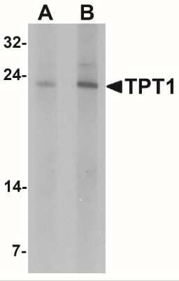 Western Blot: TPT1/TCTP Antibody [NBP2-41206] - Western blot analysis of TPT1 in human brain tissue lysate with TPT1 antibody at (A) 0.5 and (B) 1 ug/mL.