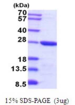 SDS-PAGE Recombinant Mouse TPT1/TCTP His Protein