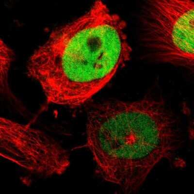 Immunocytochemistry/Immunofluorescence: TPX2 Antibody [NBP1-88312] - Staining of human cell line U-251 MG shows localization to nucleoplasm. Antibody staining is shown in green.