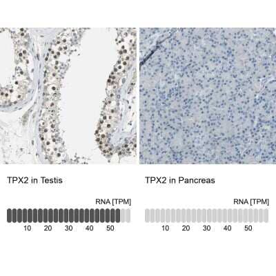 Immunohistochemistry-Paraffin: TPX2 Antibody [NBP1-88312] - Analysis in human testis and pancreas tissues using NBP1-88312 antibody. Corresponding TPX2 RNA-seq data are presented for the same tissues.