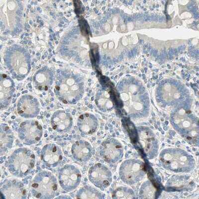 Immunohistochemistry-Paraffin: TPX2 Antibody [NBP1-88312] - Staining of human duodenum shows moderate nuclear positivity in glandular cells.