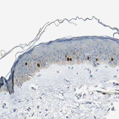 Immunohistochemistry-Paraffin: TPX2 Antibody [NBP1-88312] - Staining of human skin shows strong nuclear positivity in basal cells.