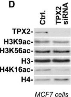 <b>Genetic Strategies Validation. </b>Knockdown Validated: TPX2 Antibody [NB500-184] - TPX2 is constitutively associated with chromatin and impacts the DAPI staining pattern and H4K16ac levels Depletion of TPX2 by siRNA causes a decrease in H4K16ac levels whereas the levels of H3K9ac and H3K56ac remain unchanged. Image collected and cropped by CiteAb from the following publication (dx.plos.org/10.1371/journal.pone.0110994), licensed under a CC-BY license.