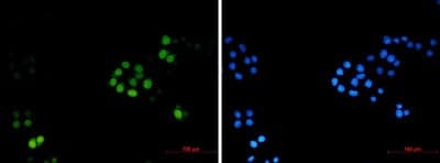 Immunocytochemistry/Immunofluorescence: TPX2 Antibody (S01-8A6) [NBP3-19922] - Immunocytochemistry of TPX2 (green) in Hela using TPX2 antibody at dilution 1/2, and DAPI (blue)