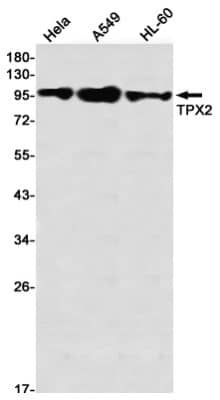 Western Blot: TPX2 Antibody (S01-8A6) [NBP3-19922] - Western blot detection of TPX2 in Hela, A549, HL-60 using NBP3-19922 (1:1000 diluted)