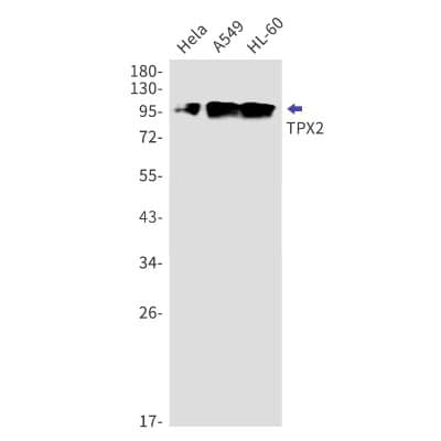 Western Blot: TPX2 Antibody (S05-1B5) [NBP3-19921] - Western blot detection of TPX2 in Hela, A549, HL-60 cell lysates using NBP3-19921 (1:1000 diluted). Predicted band size: 86kDa. Observed band size: 100kDa.