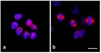 Immunocytochemistry: TPX2 Antibody (TPX2-01) [NBP2-67265] - Glioblastoma cell line T98G: a) interphase, b) mitosis. Bar: 20 um.