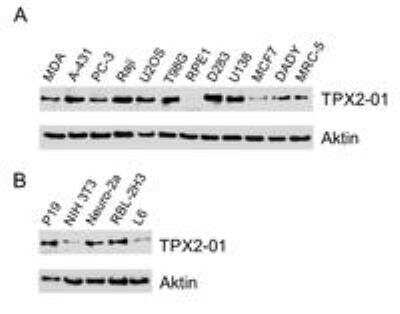 Western Blot: TPX2 Antibody (TPX2-01) [NBP2-67265] - Analysis of TPX2 using monoclonal antibody TPX2 in A) human cell lines, B) murine (P19, NIH 3T3, Neuro-2a) and rat (RBL-2H3, L6) cell lines.