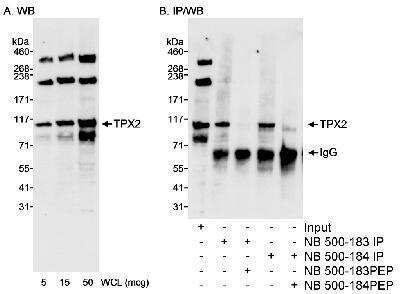 Western Blot: TPX2 Antibody [NB500-183] - Detection of Human TPX2 on HeLa whole cell lysate using NB500-183. TPX2 was also immunoprecipitated using NB500-184 at 0.4 ug/mg lysate.