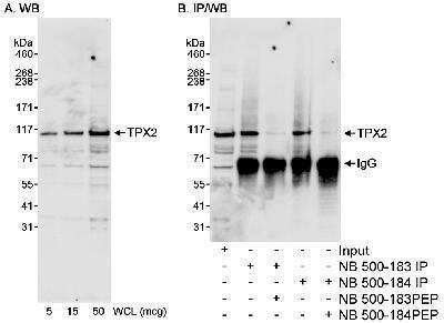 <b>Independent Antibodies Validation and Biological Strategies Validation.</b>Western Blot: TPX2 Antibody [NB500-184] - Detection of Human TPX2 on HeLa whole cell lysate using NB500-184. TPX2 was also immunoprecipitated using NB500-183 at 0.4 ug/mg lysate.