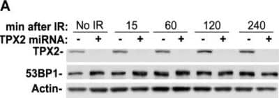 Western Blot: TPX2 Antibody [NB500-184] - Depletion of TPX2 causes defects in 53BP1 ionizing radiation-induced foci formation. The protein level of 53BP1 is not affected by miRNA-mediated depletion of TPX2. Levels of actin were used as loading controls. Image collected and cropped by CiteAb from the following publication (dx.plos.org/10.1371/journal.pone.0110994), licensed under a CC-BY license.