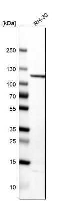 <b>Orthogonal Strategies Validation. </b>Western Blot: TPX2 Antibody [NBP1-88312] - Analysis in human cell line RH-30.