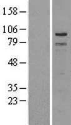 Western Blot: TPX2 Overexpression Lysate (Adult Normal) [NBL1-17236] Left-Empty vector transfected control cell lysate (HEK293 cell lysate); Right -Over-expression Lysate for TPX2.