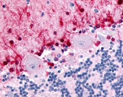 Immunohistochemistry-Paraffin: TR alpha/NR1A1/Thyroid Hormone Receptor alpha Antibody [NLS2459] - Analysis of anti-NR1D2 antibody with human brain, cerebellum.