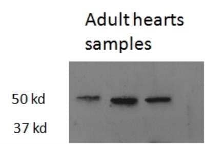 Western Blot: TR beta 1/NR1A2/Thyroid Hormone Receptor beta Antibody [NB100-93535] - Staining of Zebrafish adult Heart lysate (35 ug protein in RIPA buffer). Primary incubation was 1 hour. Detected by chemiluminescence.  