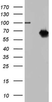 Western Blot: TR2/NR2C1 Antibody (4C7) [NBP2-46227] - Analysis of HEK293T cells were transfected with the pCMV6-ENTRY control (Left lane) or pCMV6-ENTRY NR2C1.