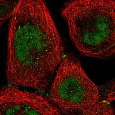 Immunocytochemistry/Immunofluorescence: TR2/NR2C1 Antibody [NBP2-55132] - Staining of human cell line A-431 shows localization to nucleus & cell junctions.