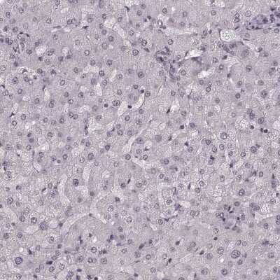 <b>Orthogonal Strategies Validation. </b>Immunohistochemistry-Paraffin: TR2/NR2C1 Antibody [NBP2-56277] - Staining of human liver shows low expression as expected.