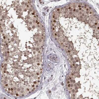 Immunohistochemistry-Paraffin: TR2/NR2C1 Antibody [NBP2-56277] - Staining of human testis shows high expression.