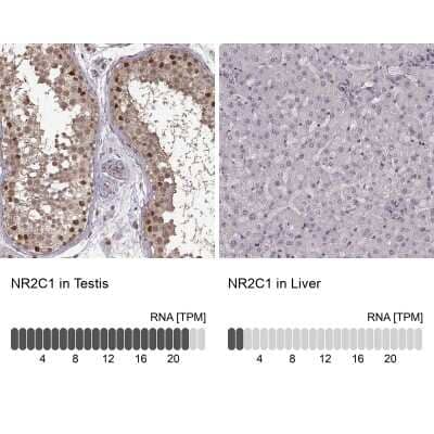 Immunohistochemistry-Paraffin: TR2/NR2C1 Antibody [NBP2-56277] - Staining in human testis and liver tissues using anti-NR2C1 antibody. Corresponding NR2C1 RNA-seq data are presented for the same tissues.