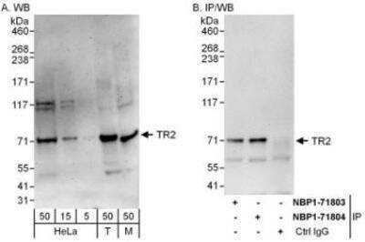 Western Blot: TR2/NR2C1 Antibody [NBP1-71803] - Whole cell lysate from HeLa (H; 50 mcg for WB; 1 mg for IP, 20% of IP loaded), 293T (5, 15, and 50 mcg for WB) and mouse NIH3T3 (M; 50 mcg) cells.  Affinity purified rabbit anti-TR2 antibody used for WB at 0.1 mcg/ml (A) and 0.4 mcg/ml (B) and used for IP at 6 mcg/mg lysate.  TR2 was also immunoprecipitated by rabbit anti-TR2 antibody NBP1-71804, which recognizes a downstream epitope.