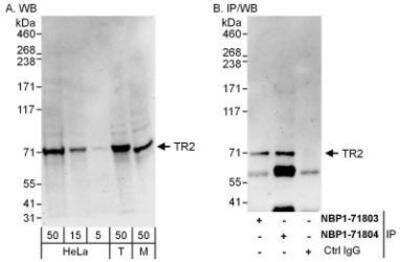 Western Blot: TR2/NR2C1 Antibody [NBP1-71804] - Whole cell lysate from HeLa (H; 50 mcg for WB; 1 mg for IP, 20% of IP loaded), 293T (5, 15, and 50 mcg for WB) and mouse NIH3T3 (M; 50 mcg) cells.   Affinity purified rabbit anti-TR2 antibody used for WB at 0.4 mcg/ml (A and B) and used for IP at 6 mcg/mg lysate.  TR2 was also immunoprecipitated by rabbit anti-TR2 antibody NBP1-71803, which recognizes an upstream epitope.