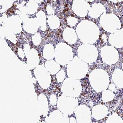 Immunohistochemistry-Paraffin: TR2IT1 Antibody [NBP2-31707] - Staining of human bone marrow shows strong cytoplasmic positivity in subset of hematopoietic cells.