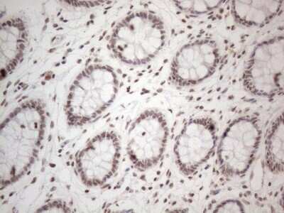 Immunohistochemistry: TR4/NR2C2 Antibody (4B1) [NBP2-46228] - Analysis of Human colon tissue. (Heat-induced epitope retrieval by 1mM EDTA in 10mM Tris buffer (pH8.5) at 120C for 3 min)