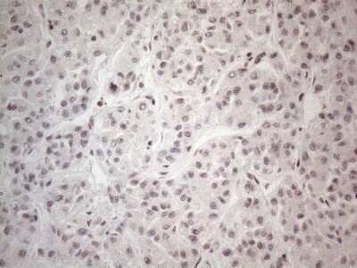 Immunohistochemistry: TR4/NR2C2 Antibody (4B1) [NBP2-46228] - Analysis of Human liver tissue. (Heat-induced epitope retrieval by 1mM EDTA in 10mM Tris buffer (pH8.5) at 120C for 3 min)