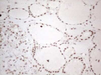 Immunohistochemistry: TR4/NR2C2 Antibody (4B1) [NBP2-46228] - Analysis of Human thyroid tissue. (Heat-induced epitope retrieval by 1mM EDTA in 10mM Tris buffer (pH8.5) at 120C for 3 min)