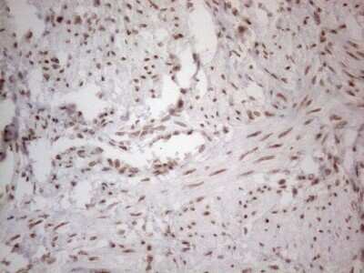 Immunohistochemistry: TR4/NR2C2 Antibody (4B1) [NBP2-46228] - Analysis of Human endometrium. (Heat-induced epitope retrieval by 1mM EDTA in 10mM Tris buffer (pH8.5) at 120C for 3 min)