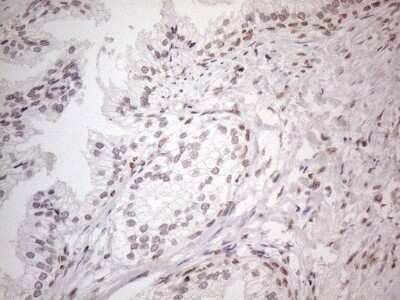 Immunohistochemistry: TR4/NR2C2 Antibody (4B1) [NBP2-46228] - Analysis of Human prostate tissue. (Heat-induced epitope retrieval by 1mM EDTA in 10mM Tris buffer (pH8.5) at 120C for 3 min)