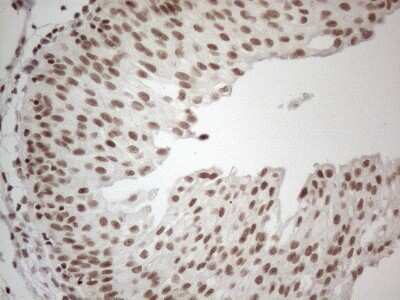 Immunohistochemistry: TR4/NR2C2 Antibody (4B1) [NBP2-46228] - Analysis of Human bladder tissue. (Heat-induced epitope retrieval by 1mM EDTA in 10mM Tris buffer (pH8.5) at 120C for 3 min)