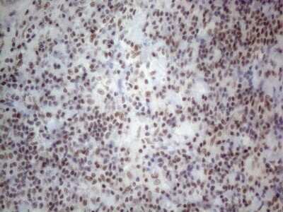 Immunohistochemistry: TR4/NR2C2 Antibody (4B1) [NBP2-46228] - Analysis of Human lymph node tissue. (Heat-induced epitope retrieval by 1mM EDTA in 10mM Tris buffer (pH8.5) at 120C for 3 min)