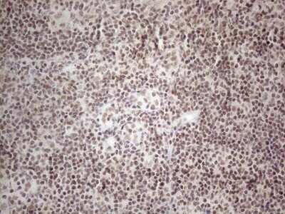 Immunohistochemistry: TR4/NR2C2 Antibody (4B1) [NBP2-46228] - Analysis of Human tonsil tissue. (Heat-induced epitope retrieval by 1mM EDTA in 10mM Tris buffer (pH8.5) at 120C for 3 min)