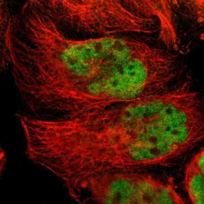 Immunocytochemistry/Immunofluorescence: TR4/NR2C2 Antibody [NBP1-81658] - Immunofluorescent staining of human cell line A-431 shows localization to nucleoplasm.