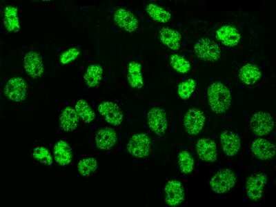 Immunocytochemistry/Immunofluorescence: TR4/NR2C2 Antibody [NBP2-97138] - Immunofluorescence staining of TR4/NR2C2 in A431 cells. Cells were fixed with 4% PFA, permeabilzed with 0.3% Triton X-100 in PBS, blocked with 10% serum, and incubated with rabbit anti-Human TR4/NR2C2 polyclonal antibody (dilution ratio 1:1000) at 4C overnight. Then cells were stained with the Alexa Fluor$488-conjugated Goat Anti-rabbit IgG secondary antibody (green). Positive staining was localized to nucleus.