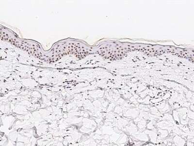 Immunohistochemistry-Paraffin: TR4/NR2C2 Antibody [NBP2-97138] - Immunochemical staining of human TR4/NR2C2 in human skin with rabbit polyclonal antibody at 1:1000 dilution, formalin-fixed paraffin embedded sections.