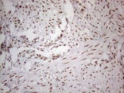 Immunohistochemistry: TR4/NR2C2 Antibody (OTI4B1) - Azide and BSA Free [NBP2-74577] - Analysis of Human endometrium. (Heat-induced epitope retrieval by 1mM EDTA in 10mM Tris buffer (pH8.5) at 120C for 3 min)