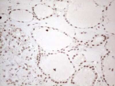 Immunohistochemistry: TR4/NR2C2 Antibody (OTI4B1) - Azide and BSA Free [NBP2-74577] - Analysis of Human thyroid tissue. (Heat-induced epitope retrieval by 1mM EDTA in 10mM Tris buffer (pH8.5) at 120C for 3 min)