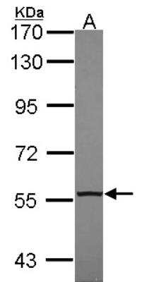 Western Blot: TR4/NR2C2 Antibody [NBP2-19579] - Sample (30 ug of whole cell lysate) A: Hela 7. 5% SDS PAGE gel, diluted at 1:1000.