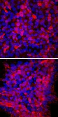 Immunocytochemistry/Immunofluorescence: TRA-1-60(R) Antibody (TRA-1-60) - Azide and BSA Free [NBP2-80985] - TRA-1-60(R) was detected in immersion fixed ADLF1 (top panel) and FAB2 (bottom panel) induced pluripotent stem cell lines using Mouse Anti-Human TRA-1-60(R) Neuraminidase Resistant Epitope Monoclonal Antibody (Catalog # NB100-730) at 10 ug/mL for 3 hours at room temperature. Cells were stained using an Anti-Mouse IgG Secondary Antibody (red) and counterstained with DAPI (blue). Specific staining was localized to cell surfaces. Image from the standard format of this antibody.