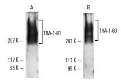 Western Blot: TRA-1-60(R) Antibody (TRA-1-60) - Azide and BSA Free [NBP2-80985] - Analysis of NB100-730 expression in NTERA-2 cl.D1 whole cell lysate. Image from the standard format of this antibody.