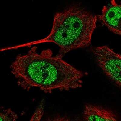 Immunocytochemistry/Immunofluorescence: TRA16 Antibody [NBP2-55864] - Staining of human cell line U-251 MG shows localization to nucleoplasm.